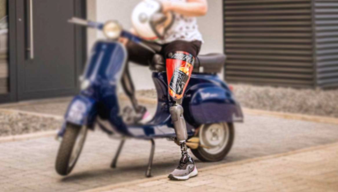 Frau auf Roller vor Haus mit Beinprothese